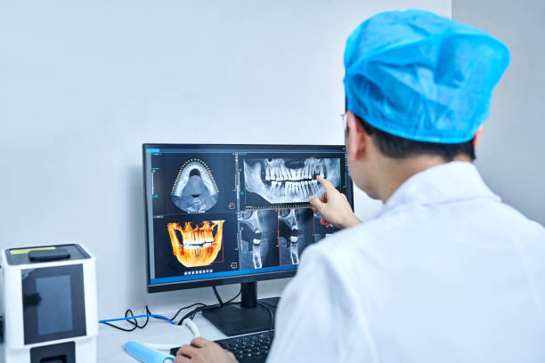 Best Knocked-Out Tooth (Avulsed Tooth) Treatment in Llender, CA